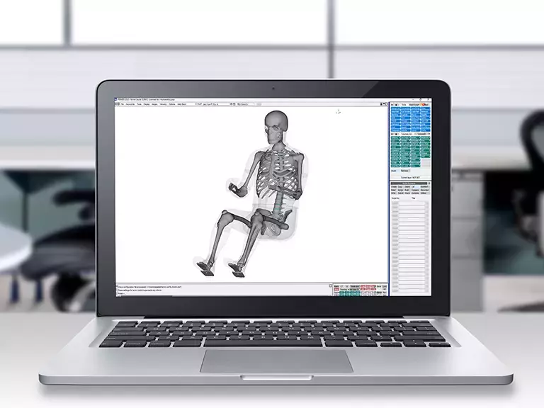 HBMConnect™ model showing skeletal structure on a laptop
